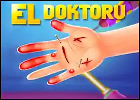 El Doktoru - Oyun oynarken elleri yara bere içinde kalan çocukları tedavi et
