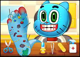 Gumball Ayak Doktoru - Oyun oynarken dikkat etmeyen gumball ayağından rahatsızlanır gumbalın yaralarını tedavi et